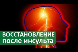 Реабилитация после инсульта